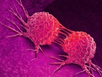 NOVA NADA ZA NAJTEŽE PACIJENTE: Novi smjer u liječenju raka mozga započinje...