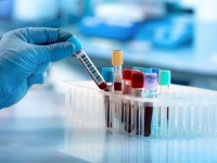 REVOLUCIONARNO OTKRIĆE: Naučnici pronašli način da predvide bolest i 10 godina unaprijed