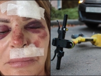 PROBLEM POSTAJE SVE VEĆI I VEĆI: Poznata hrvatska sutkinja izašla baciti smeće, zakoračila na trotoar, pa osjetila snažan udarac...