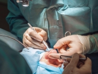 PROŽIVLJAVA PRAVU NOĆNU MORU: Muškarac izdvojio ogorman novac za 'savršeni nos', a onda uslijedio šok