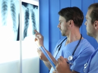 OVO JE 6 SIMPTOMA UPALE PLUĆA: Ne smijete ih ignorisati. Djeluju bezazleno, ali mogu biti opasni