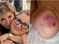 UŽAS U SARAJEVU: Brutalno pretučena kćerka poduzetnice Đemile Talić - Gabriel