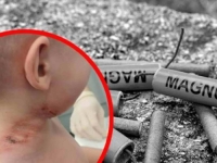 UŽAS KOD ŠIROKOG BRIJEGA: Dječak povrijeđen petardom, prebačen je u SKB Mostar