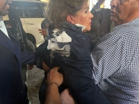 UZNEMIRUJUĆI SNIMAK: Političarka pogođena eksplozivnom napravom