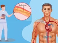 PRIRODNI SAVEZNICI: Tri supernamirnice koje balansiraju vaš holesterol