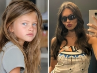 SLAVA KOJA JE NIJE PROMIJENILA: Najljepša djevojčica na svijetu danas ima 24 godine i oktriva detalje o sebi (FOTO)