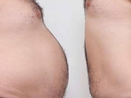 STRUČNJACI SAVJETUJU: Evo šta treba uraditi svakoga dana ukoliko ste za praznike nabacili višak kilograma...