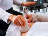 NAPREDAK MEDICINE: Britanski naučnici razvili tampon za prevenciju raka jajnika