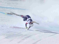 UGLEDNI HRVATSKI HIRURG O POVREDI VONN: 'To je katastrofa! Ni najbolji steznici ne pomažu na 120 km/h!'