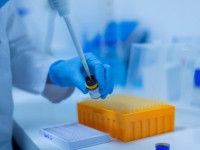 NAUČNICI SAOPĆILI VAŽNU VIJEST: Razvijen uređaj za otkrivanje ćelija koje uzrokuju karcinom