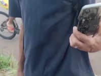 BIZARAN INDICENT: Napala ga dva agresivna psa, a onda mu je eksplozija u hlačama spasila život