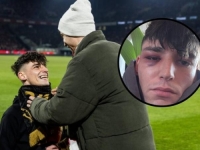 BRUTALNO PRETUČEN SUDIJA KOJI JE JAVNO ZAPROSIO SVOG MOMKA: Policija rekla da je bezbjedan, a 20 minuta kasnije ga dočekala trojica batinaša