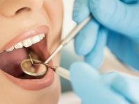 TIHE UBICE OSMIJEHA: Namirnice koje vam uništavaju zube, a vi ih jedete svaki dan