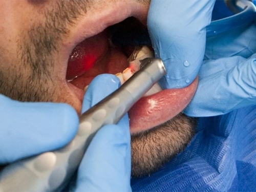 VIC DANA: Mujo ušao u zubarsku ordinaciju, sjeo u čekaonicu, a kad je došao na red – urnebes...