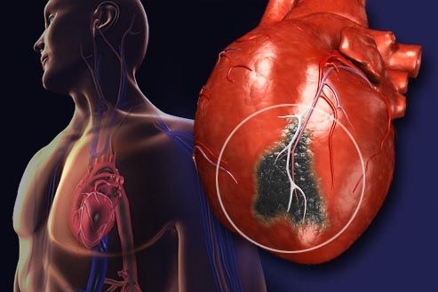 MEDICINSKA CRNA LISTA: Popis bolesti i stanja koje su najčešći uzročnici smrti...