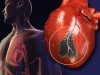 MEDICINSKA CRNA LISTA: Popis bolesti i stanja koje su najčešći uzročnici smrti...