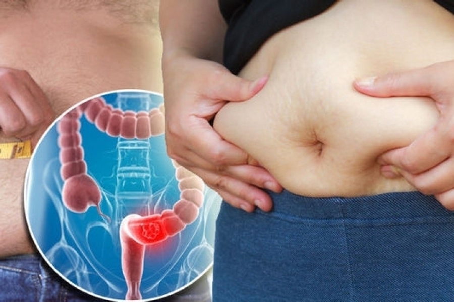 BEZ DOKTORA I SKUPIH LIJEKOVA: Ukoliko vas muči nadutost i loša probava, isprobajte rješenja iz prirode…