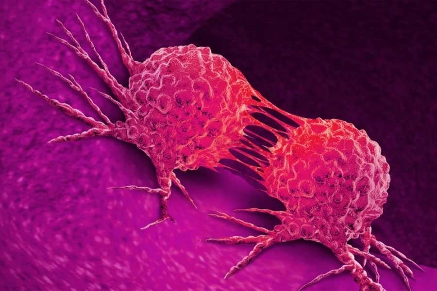 STRUČNJACI OTKRIVAJU: Može li se rak naslijediti i na šta treba obratiti pažnju...