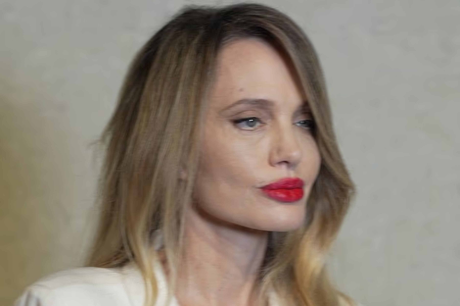 'KAO DA JE VOŠTANA LUTKA!': Plastični hirurg detaljno objasnio KAKO JE UPROPAŠTENO LICE ANGELINE JOLIE... (FOTO)