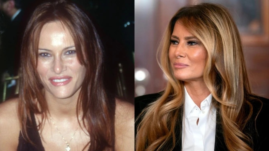 OTKRIVENA TAJNA RASKOŠNOG VOLUMENA: Kako je Melanija Tramp riješila problem tanke i prorijeđene kose - iza glamuroznog izgleda krije se JEDNOSTAVAN TRIK