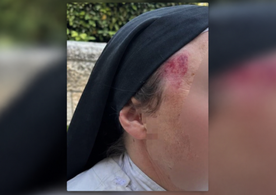 BRUTALAN NAPAD NA SVETOM MJESTU: Francuska časna sestra oborena i cipelarena, policija krije identitet napadača