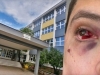 SKANDAL TRESE HERCEGOVINU: Učenik završio u bolnici nakon vršnjačkog nasilja, direktorica pobjegla iz države dok institucije šute