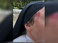 BRUTALAN NAPAD NA SVETOM MJESTU: Francuska časna sestra oborena i cipelarena, policija krije identitet napadača