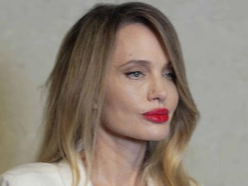 'KAO DA JE VOŠTANA LUTKA!': Plastični hirurg detaljno objasnio KAKO JE UPROPAŠTENO LICE ANGELINE JOLIE... (FOTO)