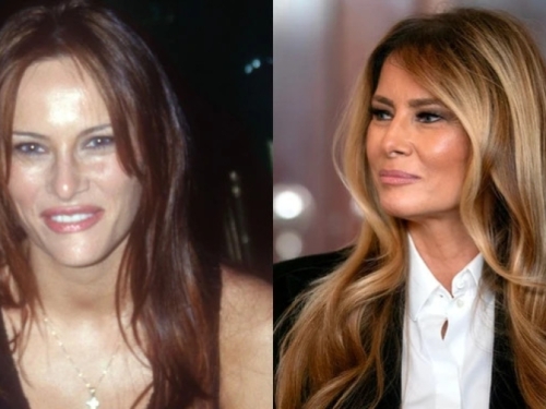 OTKRIVENA TAJNA RASKOŠNOG VOLUMENA: Kako je Melanija Tramp riješila problem tanke i prorijeđene kose - iza glamuroznog izgleda krije se JEDNOSTAVAN TRIK
