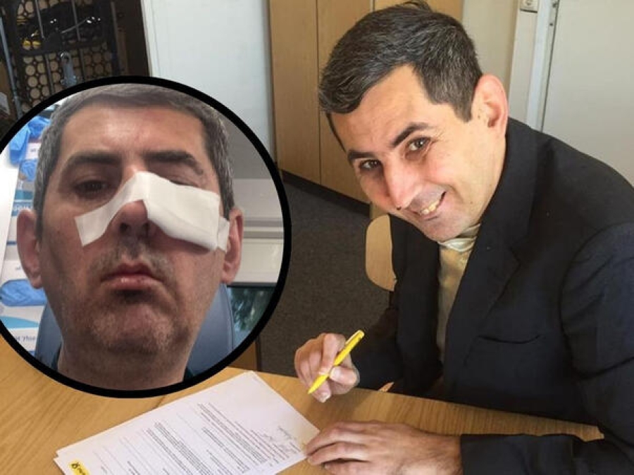 ZABAVLJAČ IZ ČAPLJINE DANIJEL BOTO PRETUČEN U NJEMAČKOJ:  'Saznao sam ko me napao...'