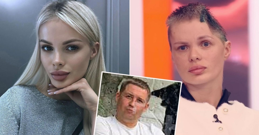 OSTALA BEZ POLA LOBANJE: Tajkun koji je monsturozno pretukao djevojku preminuo dok je čekao presudu