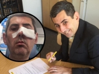 ZABAVLJAČ IZ ČAPLJINE DANIJEL BOTO PRETUČEN U NJEMAČKOJ:  'Saznao sam ko me napao...'