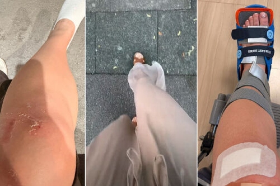 HITNE POMOĆI SE PUNE ŽRTVAMA PANTALONA IZ ZARE: Žene završavaju sa rasječenim arkadama, prijelomima i hematomima (VIDEO)