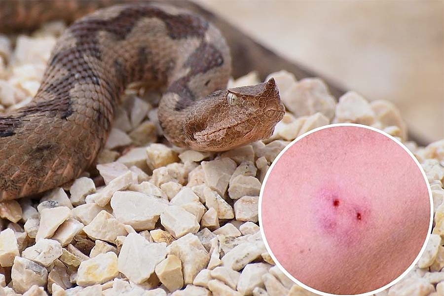 SAVJETI KOJI SPAŠAVAJU ŽIVOT: Šta treba odmah učiniti ukoliko vas ugrize zmija...