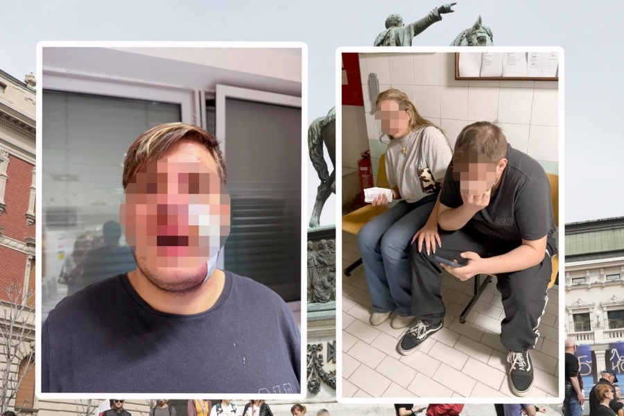'NIKO NIJE PRIŠAO DA MU POMOGNE': Uznemirujuće fotografije povreda i ispovijest majke dječaka koji je brutalno pretučen - Pita li ga 'da li je Arap', pa ga napali