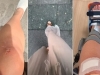 HITNE POMOĆI SE PUNE ŽRTVAMA PANTALONA IZ ZARE: Žene završavaju sa rasječenim arkadama, prijelomima i hematomima (VIDEO)