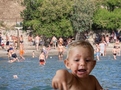 UPOZORENJE RODITELJIMA: Impetigo se širi među djecom u Splitu, ovo su prvi simptomi