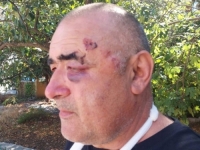 INCIDENT U RAVNOM BEZ SNIMKE: Kamere prestale raditi dva dana prije napada na Božu Raguža