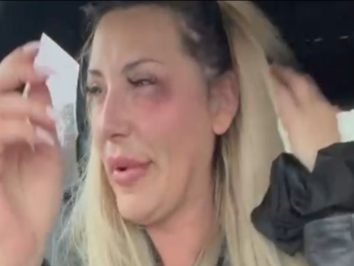 PJEVAČICA PRETUČENA U NJEMAČKOJ, OGLASILA SE GRCAJUĆI U SUZAMA: 'Umjesto profesionalnog odnosa, doživjela sam fizički napad' (VIDEO)